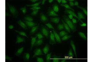 Image no. 1 for anti-Phosphoinositide 3-kinase Regulatory Subunit 4 (PIK3R4) (AA 1259-1359) antibody (ABIN599234) (PIK3R4 anticorps  (AA 1259-1359))