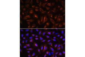 Immunofluorescence analysis of U-2 OS cells using B antibody (ABIN6130859, ABIN6137109, ABIN6137110 and ABIN6220869) at dilution of 1:100.