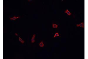 ABIN6269379 staining PC12  cells by IF/ICC. (STX1A anticorps  (N-Term))