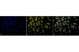 Immunocytochemistry/Immunofluorescence analysis using Rabbit Anti-KDEL Polyclonal Antibody (ABIN863187 and ABIN863188). (KDEL anticorps)