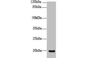 Western blot All lanes: NUDT11 antibody at 2 μg/mL + U251 whole cell lysate Secondary Goat polyclonal to rabbit IgG at 1/10000 dilution Predicted band size: 19 kDa Observed band size: 19 kDa (NUDT11 anticorps  (AA 1-164))