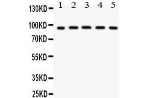 Anti- NR3C1 antibody, Western blotting All lanes: Anti NR3C1  at 0. (Glucocorticoid Receptor anticorps  (AA 1-373))