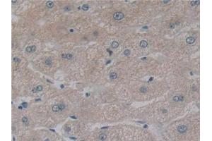 Detection of NFkB in Human Liver Tissue using Polyclonal Antibody to Nuclear Factor Kappa B (NFkB)