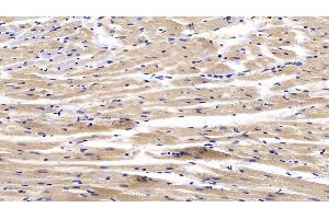 Detection of CTGF in Rabbit Cardiac Muscle Tissue using Polyclonal Antibody to Connective Tissue Growth Factor (CTGF)