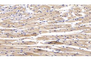Detection of CTGF in Rabbit Cardiac Muscle Tissue using Polyclonal Antibody to Connective Tissue Growth Factor (CTGF) (CTGF anticorps  (AA 118-388))