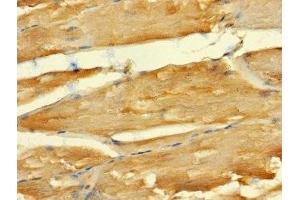 Immunohistochemistry of paraffin-embedded human skeletal muscle tissue using ABIN7143040 at dilution of 1:100 (ABLIM2 anticorps  (AA 222-521))