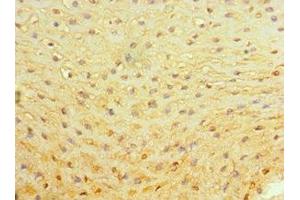 anti-Aminolevulinate, delta-, Synthase 2 (ALAS2) (AA 50-320) antibody