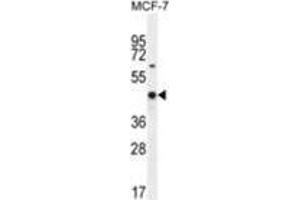 WT1 Antibody (Center E361) western blot analysis in MCF-7 cell line lysates (35 µg/lane). (WT1 anticorps  (Middle Region))
