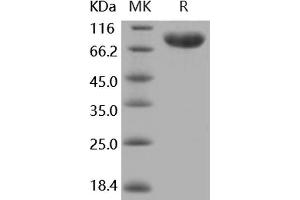 Western Blotting (WB) image for CD14 (CD14) protein (His tag,Fc Tag) (ABIN7194702)