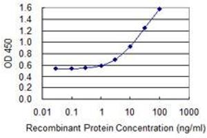 Detection limit for recombinant GST tagged SERPINA3 is 0.