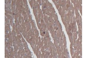 Detection of SHBG in Rat Cardiac Muscle Tissue using Monoclonal Antibody to Sex Hormone Binding Globulin (SHBG) (SHBG anticorps  (AA 222-358))
