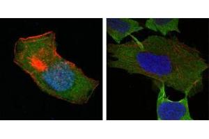 Confocal immunofluorescence analysis of HepG2 (left) and L-02 (right) cells using GSTP1 antibody (green). (GSTP1 anticorps)