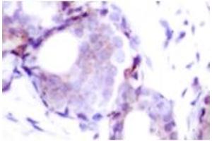 Image no. 1 for anti-Myc Proto-Oncogene protein (MYC) (pSer373) antibody (ABIN318072) (c-MYC anticorps  (pSer373))