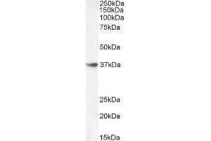 HOXA10 anticorps  (Internal Region)
