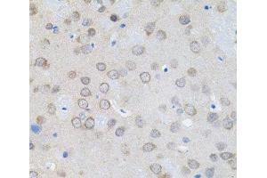 Immunohistochemistry of paraffin-embedded Rat brain using UBE2A Polyclonal Antibody