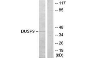Western Blotting (WB) image for anti-Dual Specificity Phosphatase 9 (DUSP9) (AA 151-200) antibody (ABIN2879162) (DUSP9 anticorps  (AA 151-200))