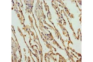 Immunohistochemistry of paraffin-embedded human lung tissue using ABIN7149965 at dilution of 1:100 (FMO5 anticorps  (AA 1-285))