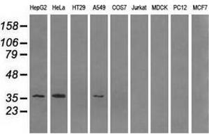 Western blot analysis of extracts (35 µg) from 9 different cell lines by using anti-AKR1A1 monoclonal antibody. (AKR1A1 anticorps)
