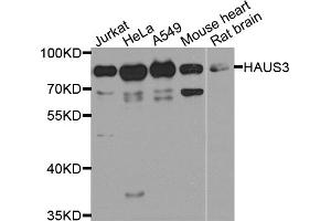 Western blot analysis of extracts of various cell lines, using HAUS3 antibody (ABIN5974538) at 1/1000 dilution. (HAUS3 anticorps)