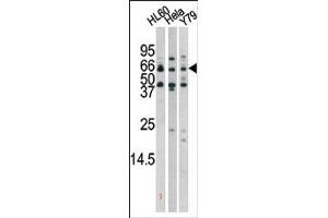 Image no. 2 for anti-RAD9 Homolog A (S. Pombe) (RAD9A) (pSer272) antibody (ABIN358200) (RAD9A anticorps  (pSer272))