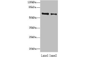 Western blot All lanes: ZNF626 antibody at 10 μg/mL Lane 1: HepG2 whole cell lysate Lane 2: Raji whole cell lysate Secondary Goat polyclonal to rabbit IgG at 1/10000 dilution Predicted band size: 61, 53, 11 kDa Observed band size: 61 kDa