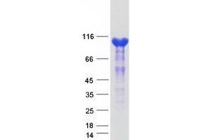 Validation with Western Blot