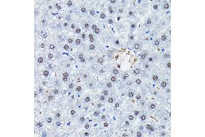 Immunohistochemistry of paraffin-embedded rat liver using C/EBPB Rabbit pAb (ABIN6134025, ABIN6138382, ABIN6138383 and ABIN6213964) at dilution of 1:100 (40x lens). (CEBPB anticorps  (AA 150-250))