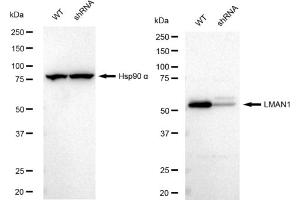 Western blotting analysis using LMAN1 antibody (ABIN7799244).