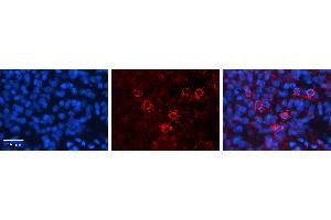 CTBP1 antibody - C-terminal region          Formalin Fixed Paraffin Embedded Tissue:  Human Pineal Tissue    Observed Staining:  Cytoplasm and nucleus in Human Pineal Tissue   Primary Antibody Concentration:  1:100    Other Working Concentrations:  1/600    Secondary Antibody:  Donkey anti-Rabbit-Cy3    Secondary Antibody Concentration:  1:200    Magnification:  20X    Exposure Time:  0. (CTBP1 anticorps  (C-Term))