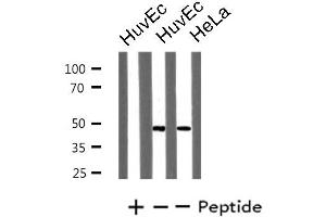 Western blot analysis of extracts from HuvEc/HeLa cells, using LHX1 antibody. (LHX1 anticorps  (Internal Region))