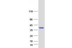 Validation with Western Blot