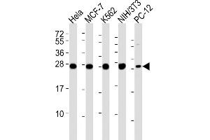 Lane 1: HeLa Cell lysates, Lane 2: MCF-7 Cell lysates, Lane 3: K562 Cell lysates, Lane 4: NIH/3T3 Cell lysates, Lane 5: PC-12 Cell lysates, probed with IF4E (1504CT774. (EIF4E2 anticorps)