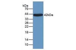 Figure. (ORM1 anticorps  (AA 19-201))