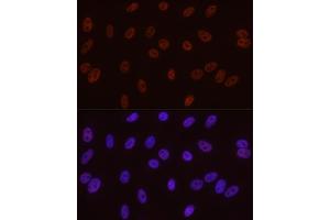 Immunofluorescence analysis of A-549 cells using Phospho-POLR2A CTD-S5 antibody  at dilution of 1:50 (40x lens). (POLR2A/RPB1 anticorps  (pSer5))