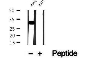 Western blot analysis of extracts of A375 cells, using Histone H1.