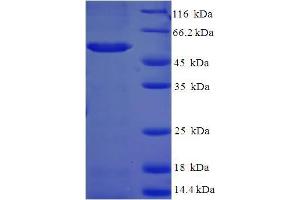 SDS-PAGE (SDS) image for Aldo-keto Reductase Family 1, Member C2 (AKR1C2) (AA 1-323), (full length) protein (His-SUMO Tag) (ABIN5709029) (AKR1C2 Protein (AA 1-323, full length) (His-SUMO Tag))
