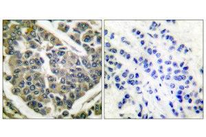 Immunohistochemistry (IHC) image for anti-Collagen, Type IV (COL4) (N-Term) antibody (ABIN1848478)