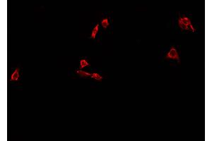 ABIN6273452 staining A549 cells by IF/ICC.