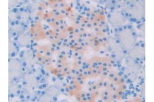 DAB staining on IHC-P; Samples: Rat Pancreas Tissue (UCP2 anticorps  (AA 99-216))