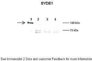 Lanes:   1: 2ug mouse SYDE1 transfected HEK293T lysate, 2: 15ug untransfected HEK293T lysate, 3: 100ug wild type mouse brain lysate, 4: 100ug SYDE1 knock-out mouse brain lysate  Primary Antibody Dilution:   1:500  Secondary Antibody:   Anti-rabbit L-chain HRP  Secondary Antibody Dilution:   1:10,000  Gene Name:   SYDE1  Submitted by:   Anonymous