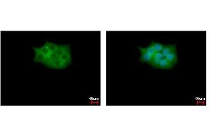 ICC/IF Image SCAP2 antibody [C2C3], C-term detects SKAP2 protein at cytoplasm by immunofluorescent analysis. (SKAP2 anticorps  (C-Term))