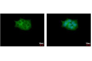 ICC/IF Image SCAP2 antibody [C2C3], C-term detects SKAP2 protein at cytoplasm by immunofluorescent analysis.