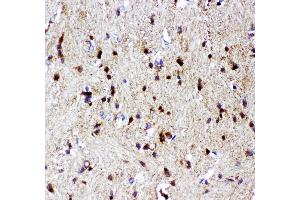 Anti- p73 antibody, IHC(P) IHC(P): Rat Brain Tissue