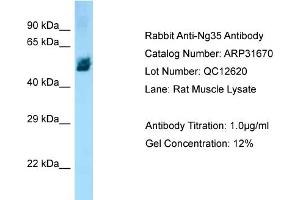 WB Suggested Anti-Ng35 Antibody   Titration: 1. (ZBTB12 anticorps  (Middle Region))