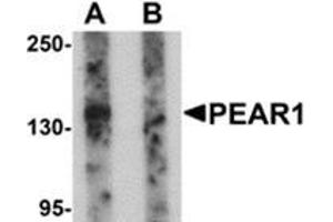 Western blot analysis of PEAR1 in rat kidney tissue lysate with PEAR1 antibody at 1 μg/ml in (A) the absence and (B) the presence of blocking peptide. (PEAR1 anticorps  (C-Term))