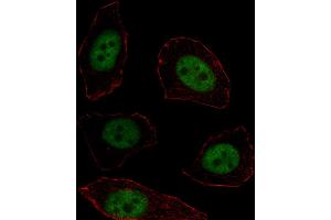 Fluorescent image of U251 cell stained with MSX1 Antibody . (MSX1 anticorps  (AA 111-138))