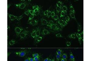 Immunofluorescence analysis of C6 cells using CYB5A Polyclonal Antibody at dilution of 1:100 (40x lens).