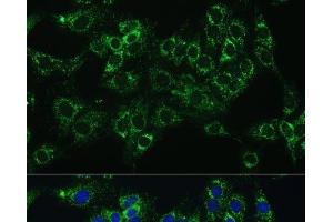 Immunofluorescence analysis of C6 cells using CYB5A Polyclonal Antibody at dilution of 1:100 (40x lens). (CYB5A anticorps)