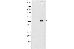 Western blot analysis of Smad2 expression in 293 whole cell lysates,The lane on the left is treated with the antigen-specific peptide. (SMAD2 anticorps  (Internal Region))