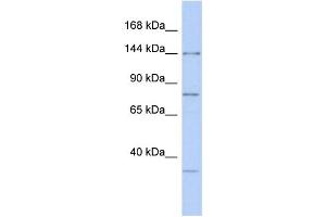 WB Suggested Anti-RNASEN Antibody Titration:  0. (DROSHA anticorps  (Middle Region))